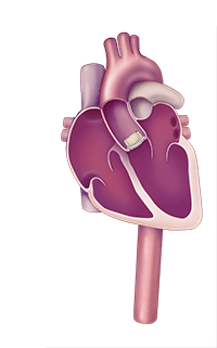 anatomical-heart-with-sapien-3-illustration