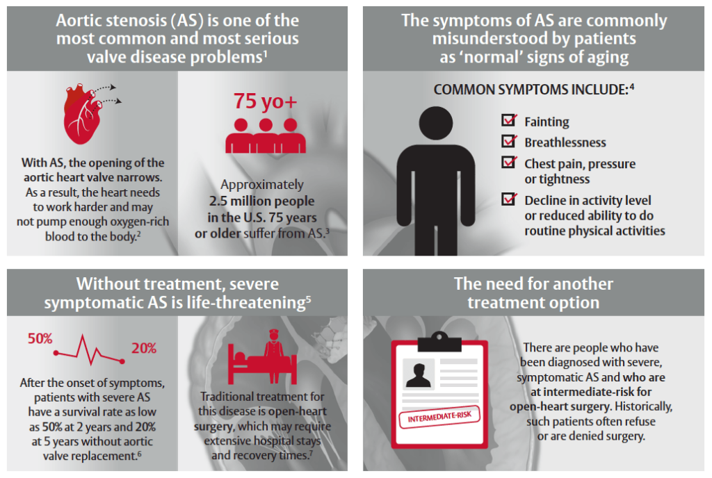 aortic-stenosis-infographic